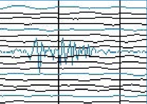 Shake It Up with Seismographs