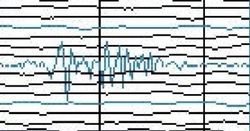 Shake It Up with Seismographs